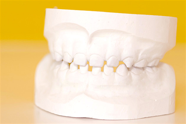 健全な乳歯の歯並び